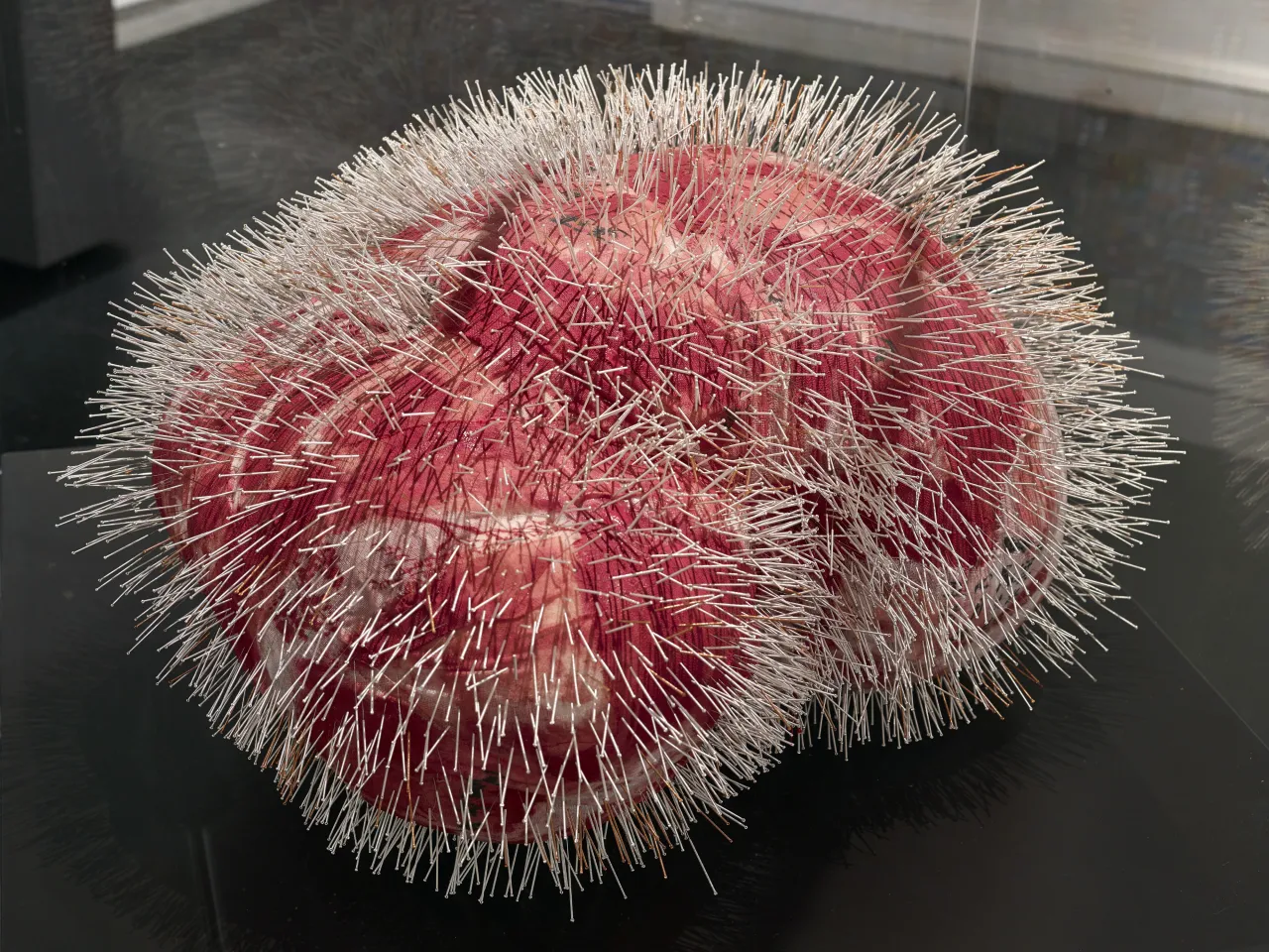 All the Volcanoes are Nothing but Acne by Zhang Yanzi at Surgeons' Hall Museums. Credit: John McKenzie and Galerie Ora-Ora