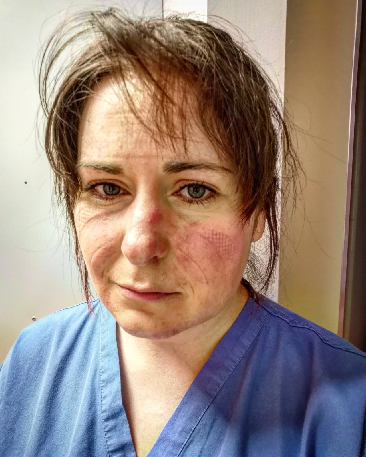 Nurse Aimée Goold after a 13-hour shift treating coronavirus patients © Aimée Goold