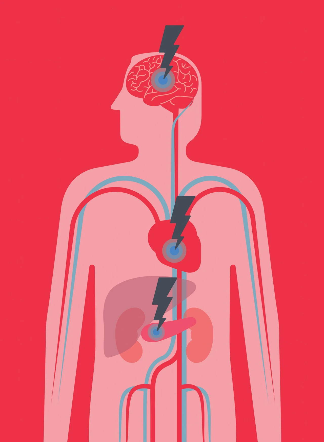 An illustration for the British Heart Foundation, showing some of the effects of Diabetes on the body © Andrew Baker